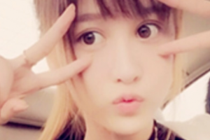 西安解放軍第323醫(yī)院整形美容科王瑞整形價(jià)格表附眼部綜合案例展示