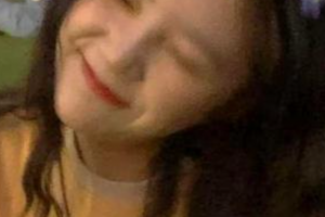 西安華旗唯美醫(yī)療美容門(mén)診部趙鵬飛整形價(jià)格表附金屬托槽矯正案例展示