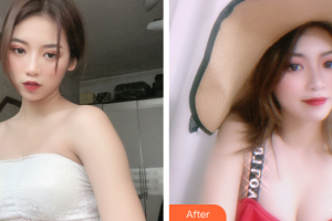 廣州懿美秀醫(yī)療美容門診部劉波整形價格表附自體脂肪隆胸案例展示