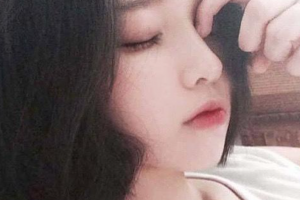 西安華仁醫(yī)院整形美容中心耿延鵬整形價(jià)格表附激光祛斑案例展示