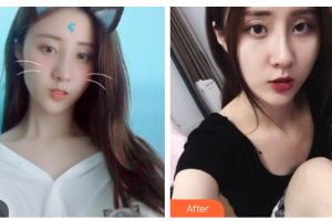 西安瑞麗斯美容整形醫(yī)院任華整形價格表附激光祛斑案例展示