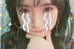 西安藝星醫(yī)療整形美容醫(yī)院宋蔚1整形價格表附玻尿酸精華導(dǎo)入案例展示