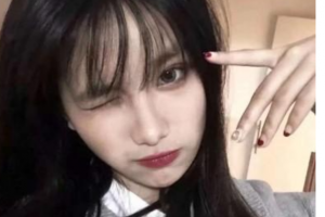 西安順美醫(yī)療美容門診部屈怡整形價格表附去痘印痘坑案例展示