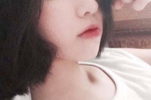 西安麗星美嘉兒醫(yī)療美容醫(yī)院王麗整形價格表附水氧活膚案例展示