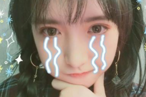 西安市第一醫(yī)院眼科龍?zhí)墩蝺r(jià)格表附切開雙眼皮案例展示