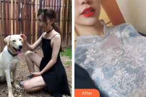 合肥福華醫(yī)療美容醫(yī)院柳大烈整形價格表附自體脂肪隆胸案例展示