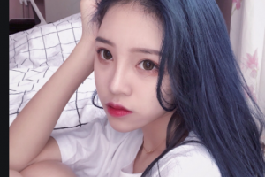 西安中諾口腔醫(yī)院蘇雪梅整形價(jià)格表附金屬托槽矯正案例展示