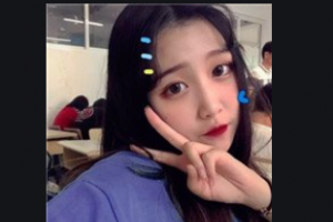 西安普瑞眼科醫(yī)院康軍整形價格表附切開雙眼皮案例展示