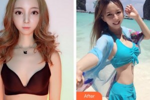 合肥壹美尚美容醫(yī)院李艷東整形價(jià)格表附自體脂肪隆胸案例展示