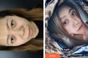 合肥玉顏醫(yī)療美容門診部周瑜整形價(jià)格表附切開雙眼皮案例展示