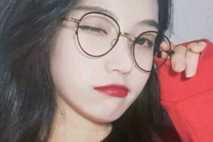 長(zhǎng)沙藝星醫(yī)學(xué)美容醫(yī)院金恩秀整形價(jià)格表附埋線提升案例展示