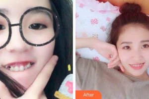 合肥瑞特曼口腔門診部金多貴整形價格表附牙齒矯正案例展示