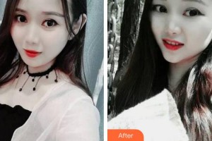 合肥佳德口腔門診部王炳節(jié)整形價格表附牙齒矯正案例展示