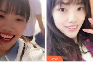 合肥拜博口腔醫(yī)院胡庚濤整形價格表附牙齒陶瓷矯正案例展示