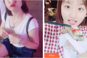 合肥貝杰口腔醫(yī)院周健整形價(jià)格表附美白劑美白牙齒案例展示