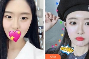 蕪湖華美醫(yī)療美容診所高翠蘭整形價(jià)格表附眼部整形案例展示