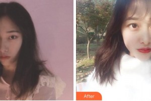 蕪湖眼科醫(yī)院（弋江區(qū)醫(yī)院）汪亮整形價(jià)格表附切開(kāi)雙眼皮案例展示