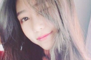 長(zhǎng)沙星雅醫(yī)療美容醫(yī)院胡曉健整形價(jià)格表附激光祛斑案例展示