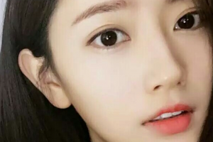 長(zhǎng)沙真愛整形美容醫(yī)院曾科鋒整形價(jià)格表附去痘印痘坑案例展示