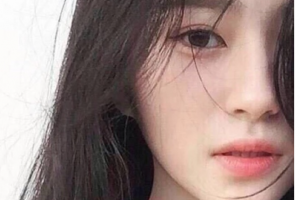 長(zhǎng)沙半島醫(yī)學(xué)美容醫(yī)院羅建國(guó)整形價(jià)格表附玻尿酸豐面頰案例展示