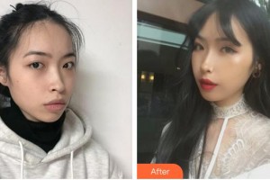 蚌埠時(shí)光鎖美容整形外科診所張武漢整形價(jià)格表附自體脂肪豐面頰案例展示