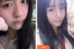 蚌埠韓美美萊醫(yī)療美容門(mén)診部周娜整形價(jià)格表附熱瑪吉案例展示