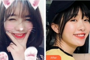 蚌埠三愛口腔門診部鄭永光整形價格表附冷光美白案例展示