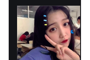 長沙世錦醫(yī)療美容醫(yī)院王瓊整形價格表附瘦肩案例展示