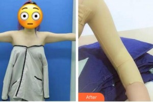 淮北東方美萊塢醫(yī)療美容醫(yī)院張莉整形價格表附美體塑形案例展示