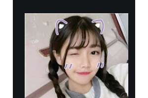 長(zhǎng)沙時(shí)光醫(yī)療美容醫(yī)院李博整形價(jià)格表附自體脂肪全臉填充案例展示