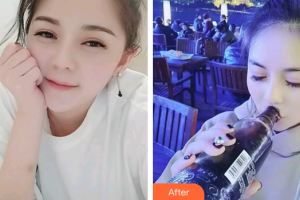 廣州海峽醫(yī)學整形美容醫(yī)院王釗偉整形價格表附冷光美白案例展示