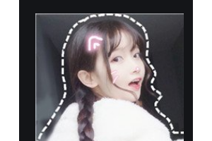 長(zhǎng)沙青和醫(yī)療美容診所陳志穎整形價(jià)格表附自體脂肪全臉填充案例展示