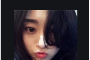 長(zhǎng)沙優(yōu)享新天地口腔門診部付麗娟整形價(jià)格表附牙齒隱形矯正案例展示