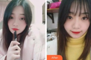 淮北博愛口腔醫(yī)院黃美玲整形價(jià)格表附牙齒隱形矯正案例展示