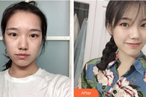 阜陽(yáng)王小妹醫(yī)學(xué)美容整形門診部王小妹整形價(jià)格表附祛疤案例展示