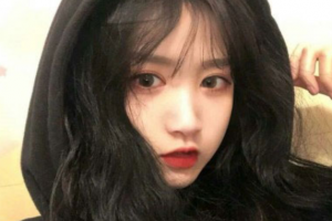 長沙愛爾眼科醫(yī)院羅麗佳整形價(jià)格表附切開雙眼皮案例展示