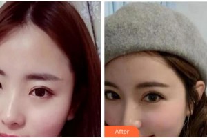 阜陽愛齒口腔門診部馬厚明整形價(jià)格表附眼部修復(fù)案例展示