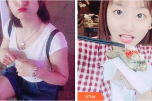 阜陽愛齒口腔門診部蔣成坤整形價(jià)格表附美白劑美白牙齒案例展示