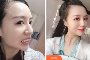 阜陽愛齒口腔門診部彭博整形價(jià)格表附牙齒隱形矯正案例展示