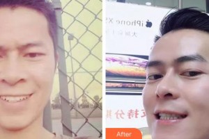 阜陽愛齒口腔門診部韋磊整形價(jià)格表附金屬托槽矯正案例展示