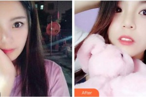 阜陽愛齒口腔門診部趙艷整形價(jià)格表附牙齒矯正案例展示