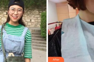 阜陽貝德口腔門診部王世惟整形價(jià)格表附牙齒陶瓷矯正案例展示