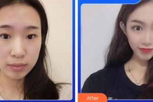 阜陽澤明眼科醫(yī)院王利平整形價(jià)格表附眼部綜合案例展示