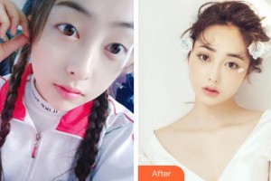 阜陽福田眼科醫(yī)院王東偉整形價(jià)格表附眼部綜合案例展示