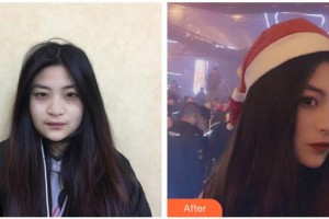 宿州韓仕醫(yī)療美容診所丁淑茹整形價(jià)格表附雙眼皮案例展示