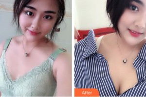 宿州天使醫(yī)療美容門診部路宏波整形價(jià)格表附隆胸案例展示