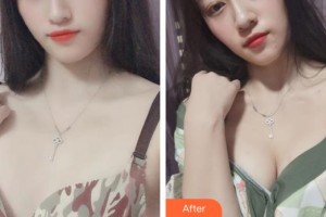 宿州康麗醫(yī)療美容門診部季輝整形價(jià)格表附豐胸案例展示