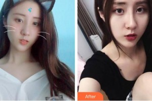 宿州惠爾美整形美容醫(yī)院陳麗華整形價(jià)格表附祛斑案例展示