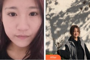 宿州漢密爾頓醫(yī)學(xué)美容醫(yī)院張躍偉整形價(jià)格表附嫩膚案例展示