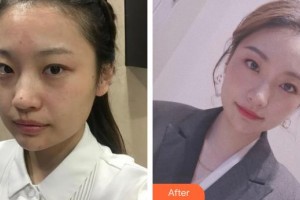 巢湖麗膚中西醫(yī)結(jié)合門診部醫(yī)療美容科馮舸整形價(jià)格表附祛斑案例展示